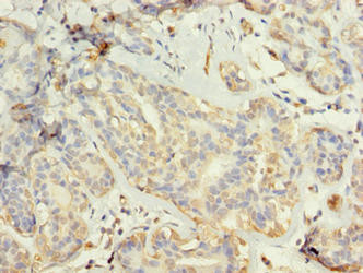 TUBG2 Antibody in Immunohistochemistry (Paraffin) (IHC (P))