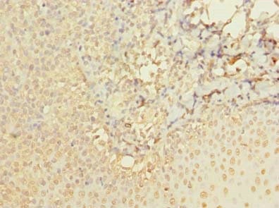 ABI3 Antibody in Immunohistochemistry (Paraffin) (IHC (P))