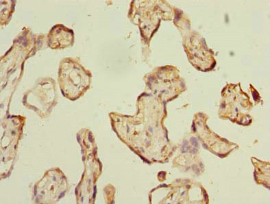 ABI3 Antibody in Immunohistochemistry (Paraffin) (IHC (P))