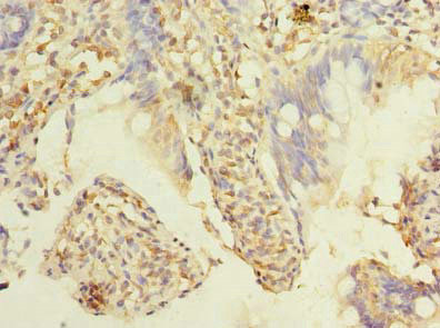 TMEM38B Antibody in Immunohistochemistry (Paraffin) (IHC (P))