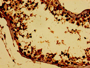 BTG4 Antibody in Immunohistochemistry (Paraffin) (IHC (P))