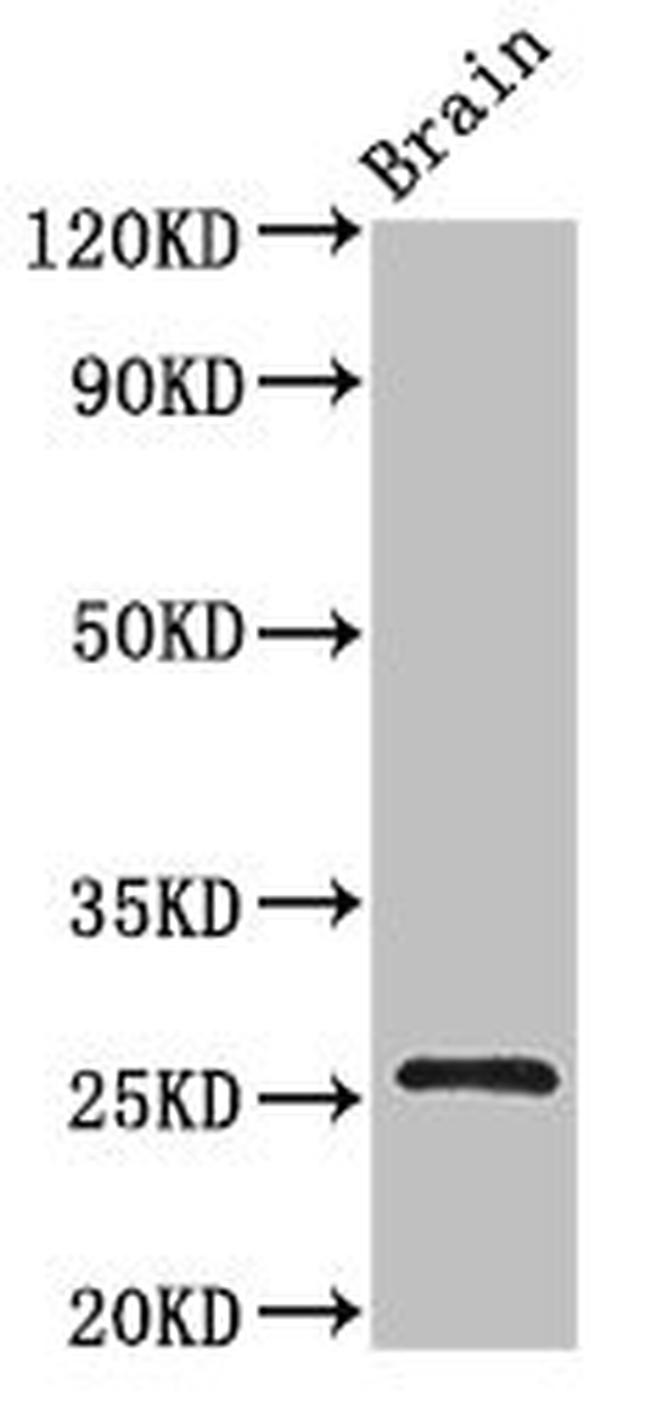 BTG4 Antibody in Western Blot (WB)