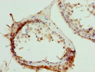 MURF2 Antibody in Immunohistochemistry (Paraffin) (IHC (P))