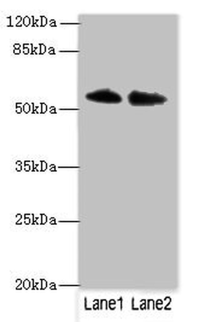 MURF2 Antibody in Western Blot (WB)