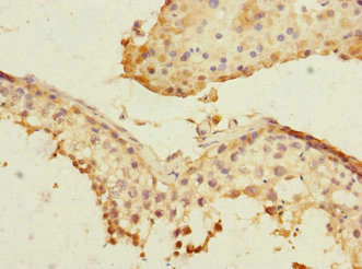 PLK3 Antibody in Immunohistochemistry (Paraffin) (IHC (P))