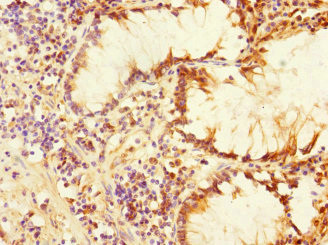 PLK3 Antibody in Immunohistochemistry (Paraffin) (IHC (P))