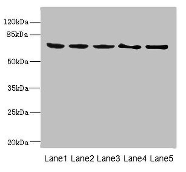 PLK3 Antibody in Western Blot (WB)