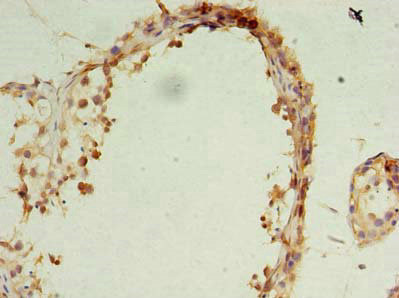 OCIAD1 Antibody in Immunohistochemistry (Paraffin) (IHC (P))