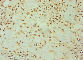 DKK4 Antibody in Immunohistochemistry (Paraffin) (IHC (P))