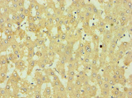 DKK4 Antibody in Immunohistochemistry (Paraffin) (IHC (P))