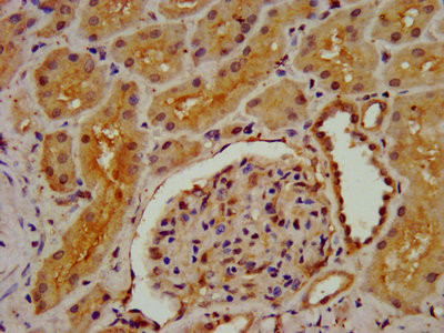 DMGDH Antibody in Immunohistochemistry (Paraffin) (IHC (P))