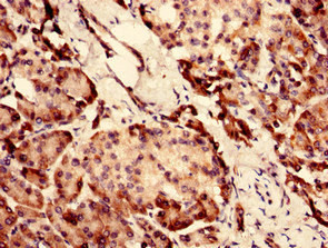 SI-CLP Antibody in Immunohistochemistry (Paraffin) (IHC (P))