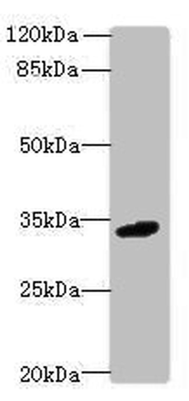 VISTA Antibody in Western Blot (WB)