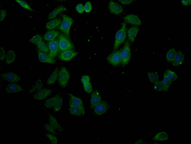 SLC28A3 Antibody in Immunocytochemistry (ICC/IF)