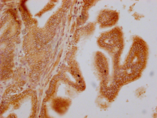 SLC28A3 Antibody in Immunohistochemistry (Paraffin) (IHC (P))