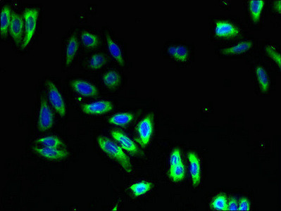 NMUR1 Antibody in Immunocytochemistry (ICC/IF)