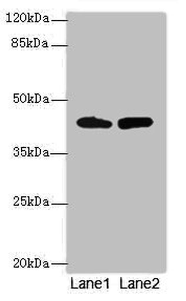 NMUR1 Antibody in Western Blot (WB)