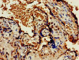 OLFML3 Antibody in Immunohistochemistry (Paraffin) (IHC (P))