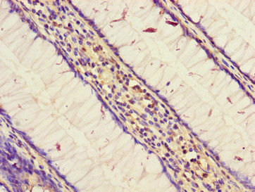 STARD9 Antibody in Immunohistochemistry (Paraffin) (IHC (P))