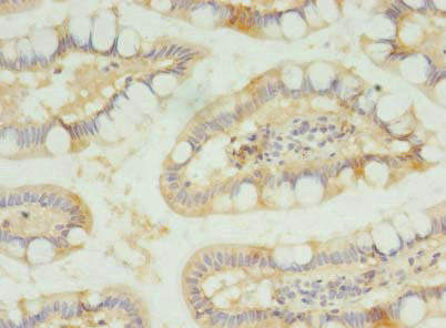 SLC23A1 Antibody in Immunohistochemistry (Paraffin) (IHC (P))