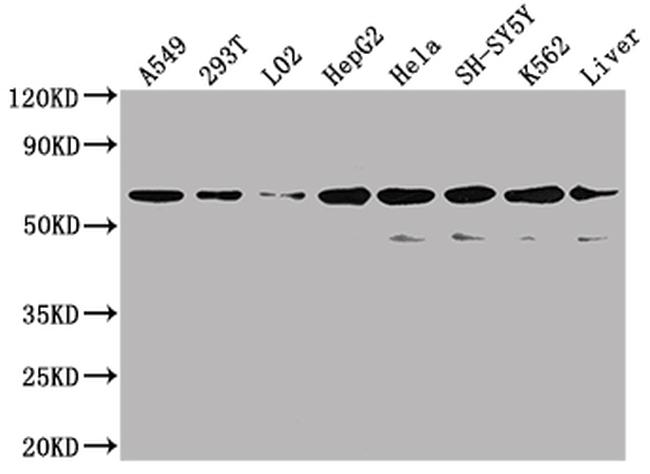 SLC23A1 Antibody in Western Blot (WB)