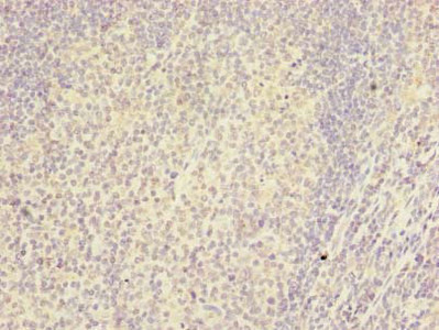 RTDR1 Antibody in Immunohistochemistry (Paraffin) (IHC (P))