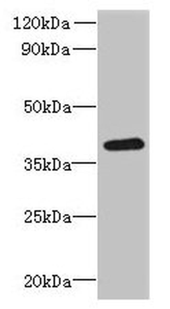 RTDR1 Antibody in Western Blot (WB)