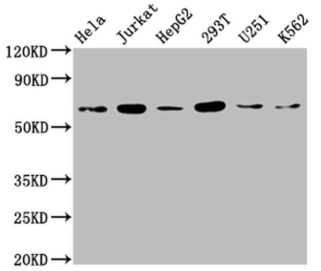 NUPL1 Antibody in Western Blot (WB)