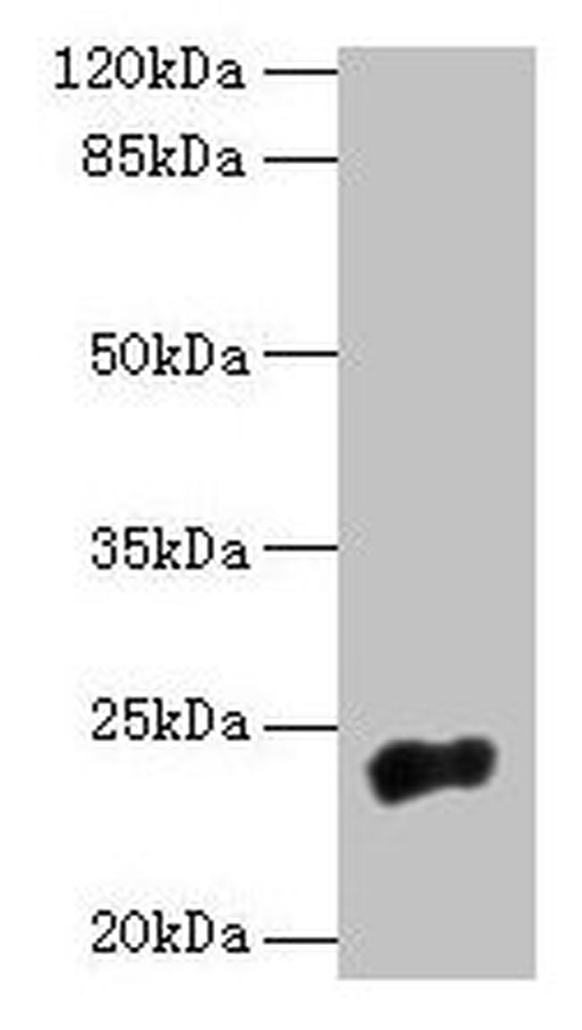 NACA2 Antibody in Western Blot (WB)