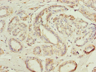 Actin-like 8 Antibody in Immunohistochemistry (Paraffin) (IHC (P))