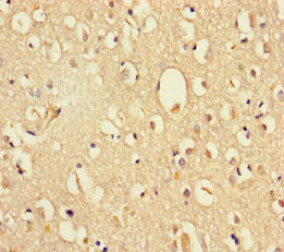 DHX35 Antibody in Immunohistochemistry (Paraffin) (IHC (P))