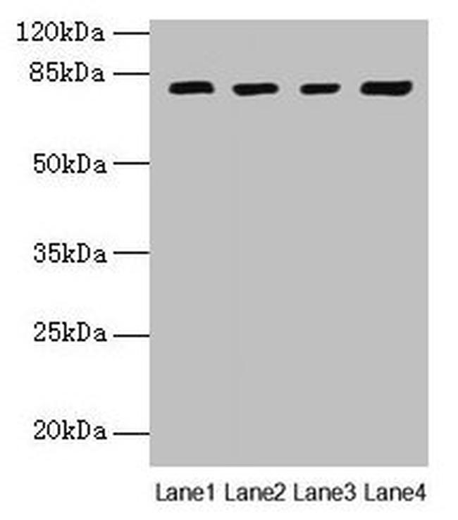 DHX35 Antibody in Western Blot (WB)