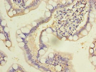 DEN2D Antibody in Immunohistochemistry (Paraffin) (IHC (P))