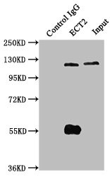 ECT2 Antibody in Immunoprecipitation (IP)