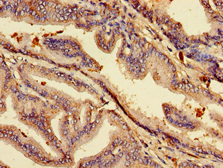 ACP6 Antibody in Immunohistochemistry (Paraffin) (IHC (P))