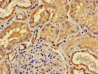 ACP6 Antibody in Immunohistochemistry (Paraffin) (IHC (P))