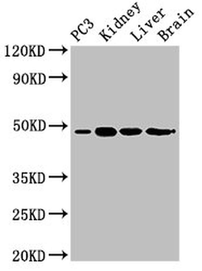 ACP6 Antibody in Western Blot (WB)