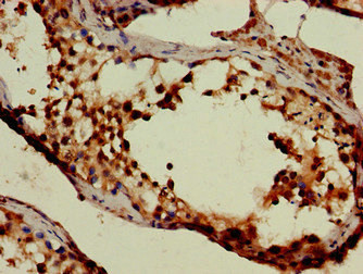 SLC6A13 Antibody in Immunohistochemistry (Paraffin) (IHC (P))