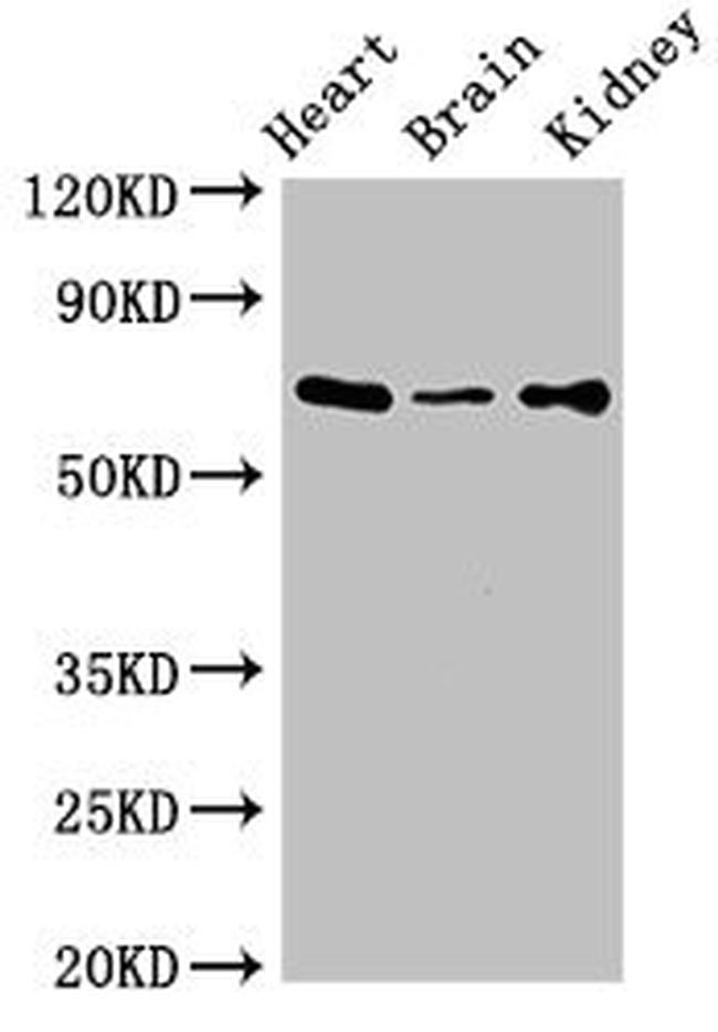 SLC6A13 Antibody in Western Blot (WB)