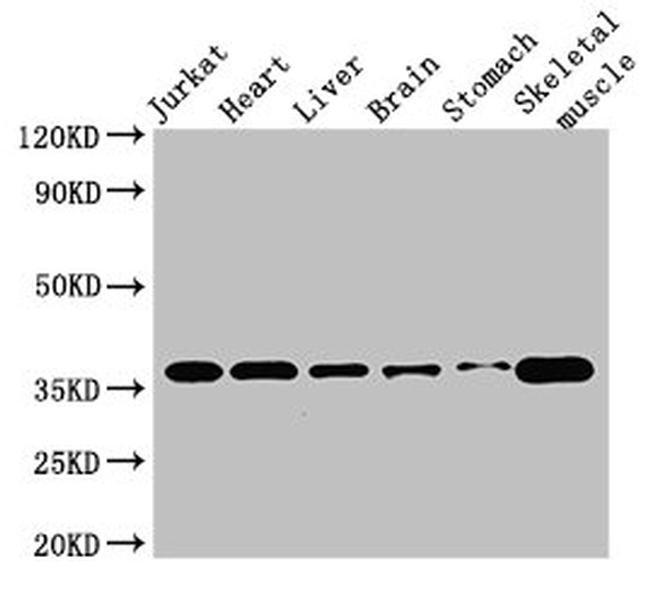 USE1 Antibody in Western Blot (WB)