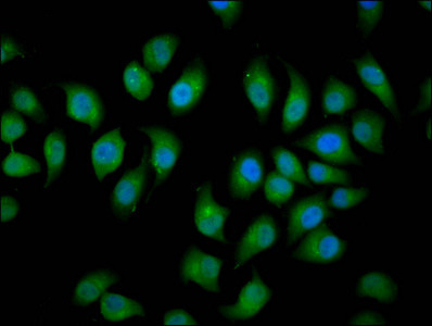 NEDL2 Antibody in Immunocytochemistry (ICC/IF)