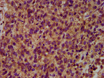 NEDL2 Antibody in Immunohistochemistry (Paraffin) (IHC (P))