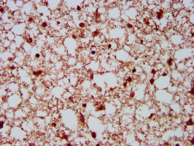 NEDL2 Antibody in Immunohistochemistry (Paraffin) (IHC (P))