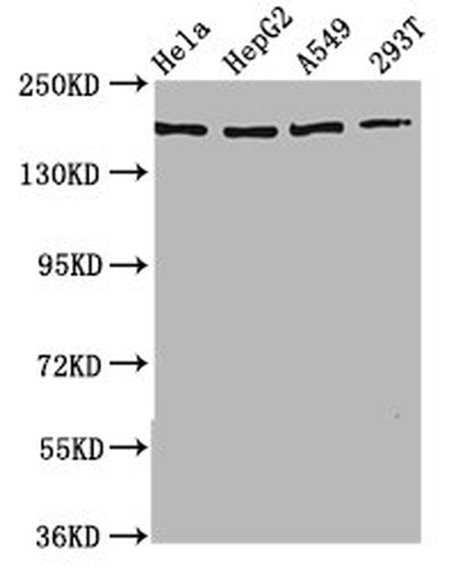 NEDL2 Antibody in Western Blot (WB)