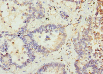 VANGL2 Antibody in Immunohistochemistry (Paraffin) (IHC (P))