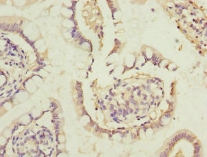 DHDH Antibody in Immunohistochemistry (Paraffin) (IHC (P))