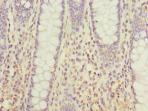 DHDH Antibody in Immunohistochemistry (Paraffin) (IHC (P))