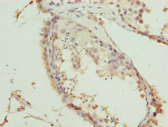 TRMT6 Antibody in Immunohistochemistry (Paraffin) (IHC (P))