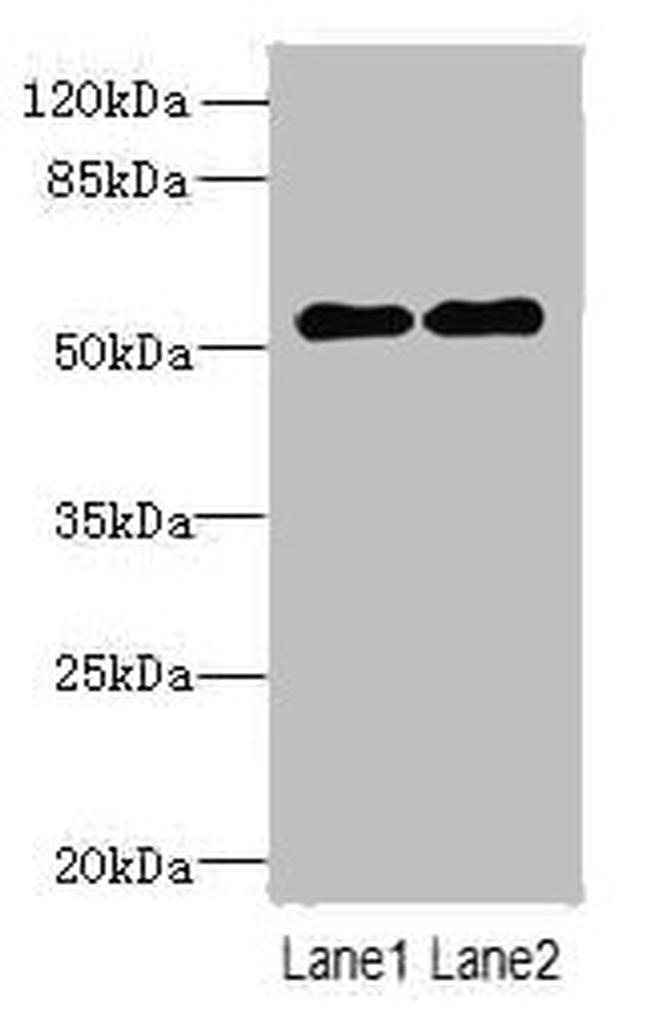 TRMT6 Antibody in Western Blot (WB)