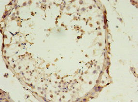 SLC13A4 Antibody in Immunohistochemistry (Paraffin) (IHC (P))